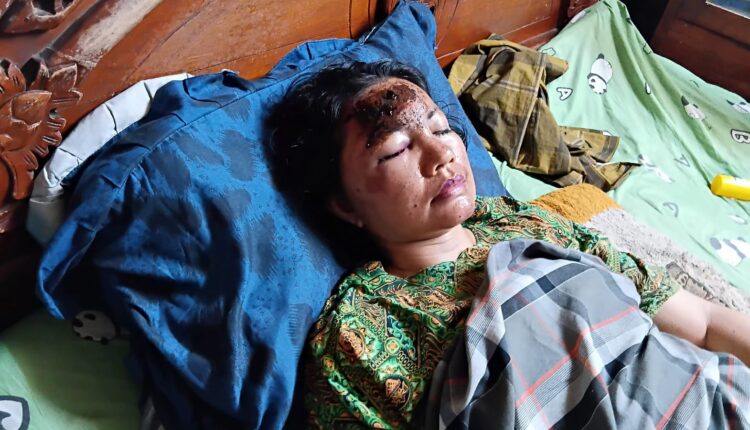 Korban tengah terbaring dengan sejumlah luka.